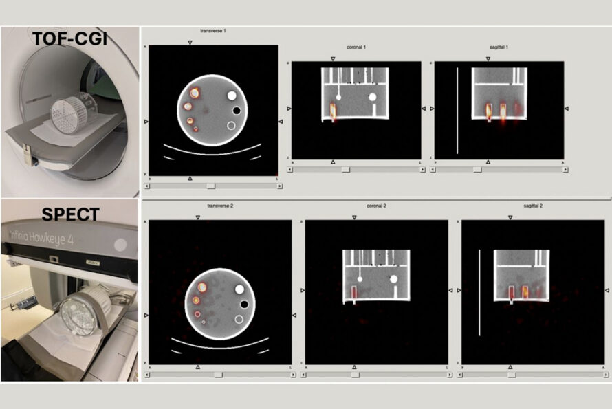 Side-by-side comparison of TOF-CGI image in a SIEMENS Vision scanner vs a SPECT image in a GE Hawkeye 4. The TOF-CGI images show much lower noise, which is reflected in superior SNR with respect to SPECT. (Credit: NSD's Applied Nuclear Physics Group)